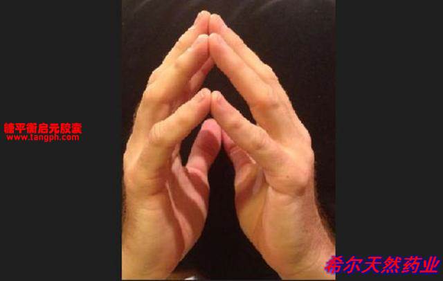 糖尿病手:一种被遗忘的并发症,不妨检查