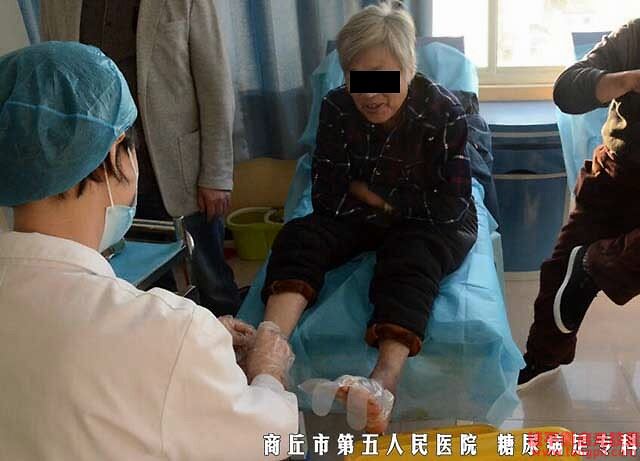 糖尿病并发症烂脚怎么把血糖降下来