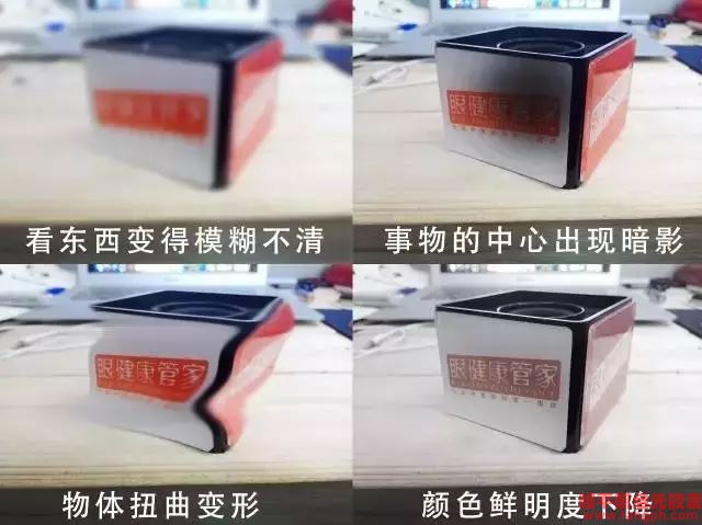 除了引发白内障和青光眼,糖尿病竟然还会